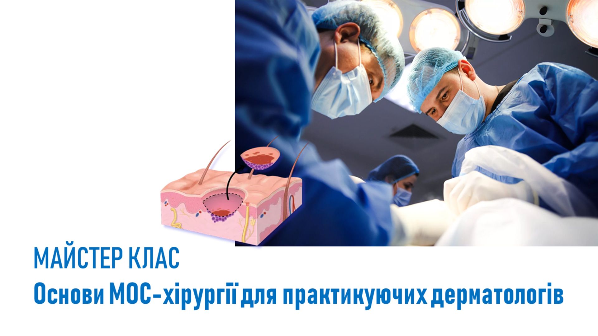 ОСНОВИ МОС-ХІРУРГІЇ ДЛЯ ПРАКТИКУЮЧИХ ДЕРМАТОВЕНЕРОЛОГІВ